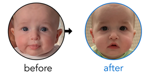 Before-and-after EarBuddies Stick-Out Ears result; started at 3–6 months – Jamie & his son Zachary