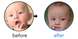 Before-and-after EarBuddies Stick-Out Ears result; started at 3–6 months – Carla & her Son Jude