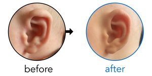 Before-and-after EarBuddies Lop Ear result; started within the first month – Charisse & her Son Björn