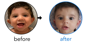 Before-and-after EarBuddies Stick-Out Ears result; started at 1–3 months – Sahar & her Son