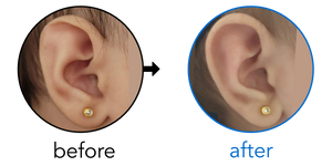 Before-and-after EarBuddies Stahl's Bar result; started at 1–3 months – Anas & her Daughter Maya