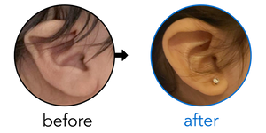 Before-and-after EarBuddies Lop Ear result; started at 1–3 months – Mrs. B & her Daughter