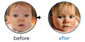 Before-and-after EarBuddies Stick-Out Ears result; started at 1–3 months – Lindsey & Baby Olivia