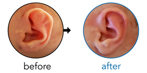 Before-and-after EarBuddies Stahl's Bar result; started within the first month – Sarah & her Son Ted
