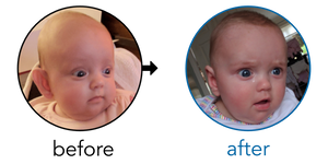 Before-and-after EarBuddies Stick-Out Ears result; started at 1–3 months – Paris S & Baby Olivia
