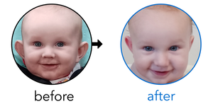 Before-and-after EarBuddies Stick-Out Ears result; started at 3–6 months – Christina & her son Matthew