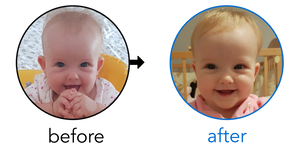 Before-and-after EarBuddies Stick-Out Ears result; started at 6–12 months – Ana, Milan & their Daughter Andrea