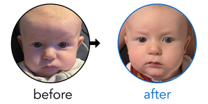Before-and-after EarBuddies Stick-Out Ears result; started at 1–3 months – Sharon & her son Mason