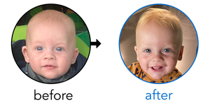 Before-and-after EarBuddies Stick-Out Ears result; started at 3–6 months – Lisa, Ben & their Son Remy