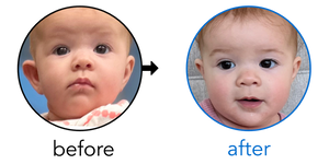 Before-and-after EarBuddies Stick-Out Ears result; started at 3–6 months – Christina & her daughter Ava