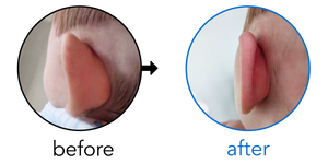 Before-and-after EarBuddies Stick-Out Ears result; started at 1–3 months – Loretta & her baby