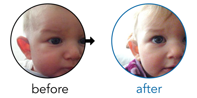 Before-and-after EarBuddies Stick-Out Ears result; started at 1–3 months – Sofia & her Daughter
