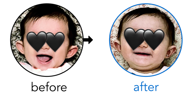 Before-and-after EarBuddies Stick-Out Ears result; started at 3–6 months – Alexandra & her Daughter Julia