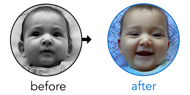 Before-and-after EarBuddies Stick-Out Ears result; started at 1–3 months – @earbuddies_journey
