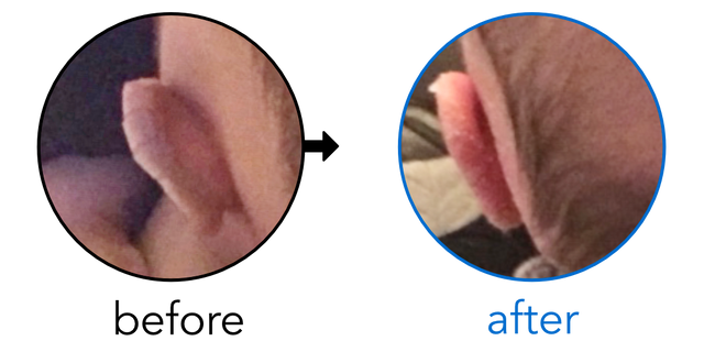 Before-and-after EarBuddies Lop Ear result; started at 1–3 months – Kat & her son Luke