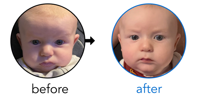 Before-and-after EarBuddies Stick-Out Ears result; started at 1–3 months – Sharon & her son Mason